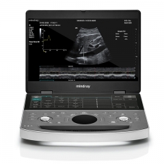 Mindray ME Series General Purpose Medical Ultrasound Scanner for Human Imaging in Hospital and Clinical Applications