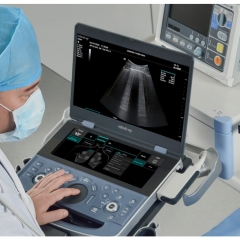 Mindray ME Series General Purpose Medical Ultrasound Scanner for Human Imaging in Hospital and Clinical Applications