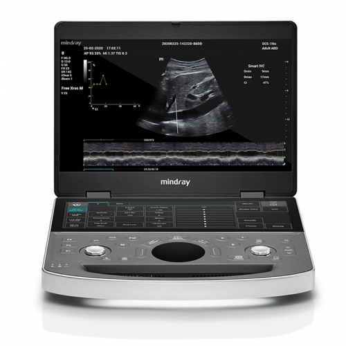 Mindray DC-80A Doppler Abdominal Ultrasound Machine Ultrasound Medical for Pregnancy Human