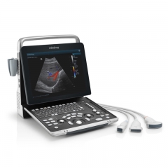 Mindray Z60 Vet Cost-Effective Premium Veterinary Ultrasound Delivering Clinical Value and High Return on Investment