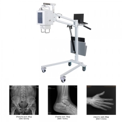 IN-MS Medical Mobile Digital X Ray Machine Portable Xray Machine Medical X-ray Fluoroscopy X-ray Machine