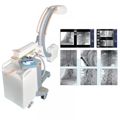 IN-HP3360A Hospital Diagnosis High Frequency Digital C-arm X Ray Mobile Digital C Arm X Ray Machine