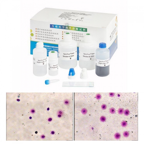 IN-200BC1 Complete kit enables simple operation with results in 1 hour using a standard microscope