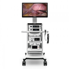 Mindray UX1 Series 4K Laparoscopic Camera System with Real-Time Recording and Intelligent Scene Recognition