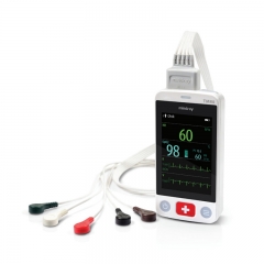 Mindray BeneVision TM80 Telemetry Patient Monitor System with Wireless Connectivity and Real-Time Vital Signs Tracking