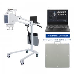 IN-MS Medical Mobile Digital X Ray Machine Portable Xray Machine Medical X-ray Fluoroscopy X-ray Machine