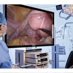 Mindray UX3 Series 4K Laparoscopic Camera System with Auto Scene Recognition and Enhanced Image Clarity