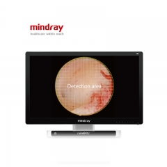 Mindray UX3 Series 4K Laparoscopic Camera System with Auto Scene Recognition and Enhanced Image Clarity