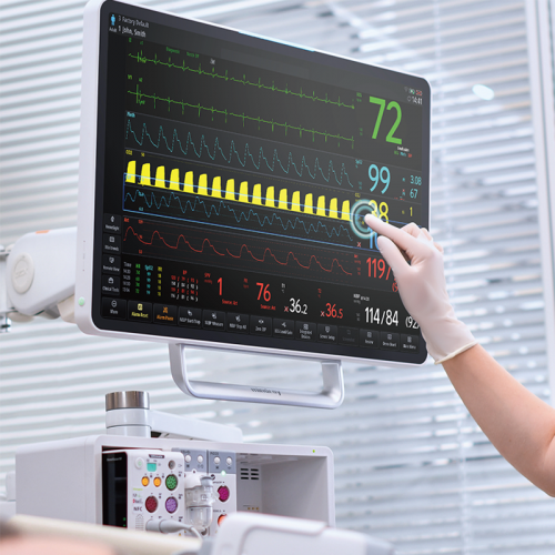 Mindray UX1 Series 4K Laparoscopic Camera System with Real-Time Recording and Intelligent Scene Recognition