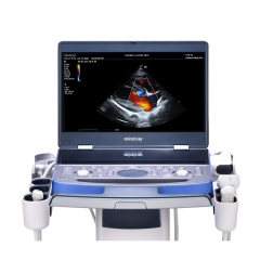 Mindray Vetus 7 Portable Ultrasound Machine for Animals with Clear Visualization and Efficient Workflow
