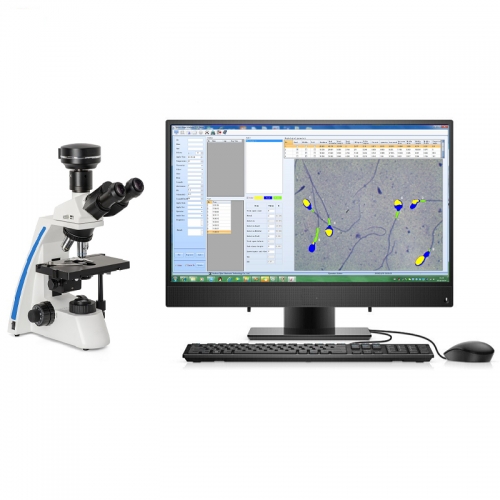 IN-QB200B Professional Sperm Analysis Equipment with AI Technology for Clinical Fertility Evaluation
