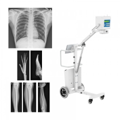 IN-5.6KW High-end Digital Portable High Frequency X Ray Machine for Medical Diagnosis