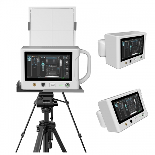 IN-560W Medical Electric Portable Hand Held Digital X Ray Machine with Flat Panel Detector