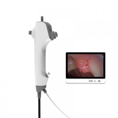 IN-DDFB Digital Portable Disposable Flexible Video Bronchoscope for Airway Examination