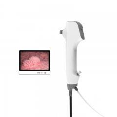 IN-DDFC Disposable Digital Flexible Cystoscope for Urology Endoscopy Equipment
