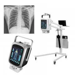 IN-8KW Portable Xray Machine Medical X-ray/Handheld DR for Radiography X Ray Diagnosis