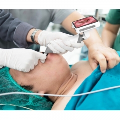 IN-VLDB Portable Disposable Video Laryngoscope for Intubation, Ideal for Hospital & ENT Use