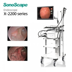 Smart Design SonoScape X-2200 series Mobile Endoscope Processor with Space-saving Layout