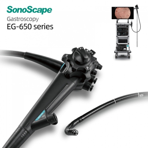 Advanced 4K Gastroscope SonoScape EG-650 for Gastrointestinal Departments