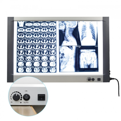 IN-1113 Professional Medical Led Film Viewer X-Ray View Box Dental X-Ray Film Illuminator Light Box X-ray Viewer LED Light