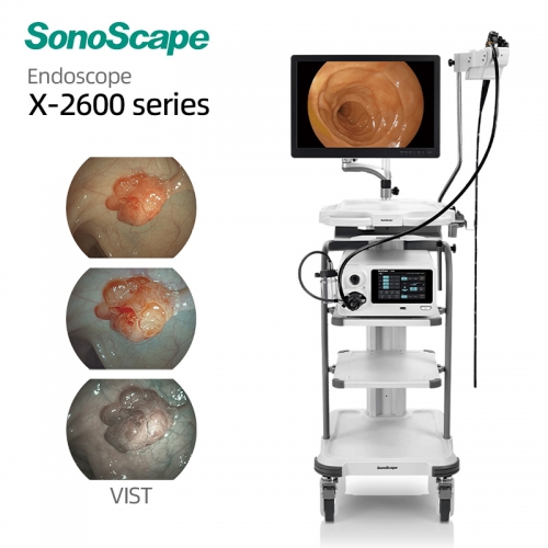 SonoScape X-2600 Medical Endoscopy System Integrated Video Endoscopy Solution