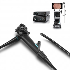 SonoScape EC-650 4K Ultra HD Colonoscope for Precise Medical Screening