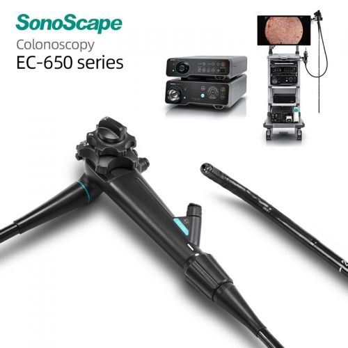 SonoScape EC-650 4K Ultra HD Colonoscope for Precise Medical Screening