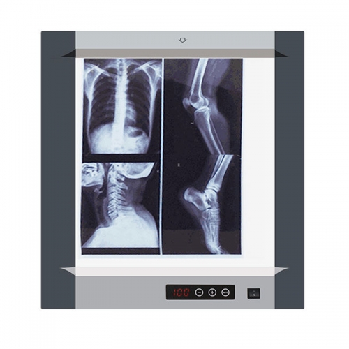 IN-1113 Hot Sales Supply Medical Double LED X-ray Film Viewer Full Digital Control X-ray Film Viewer