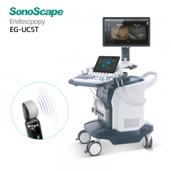 Sonoscape EG-UC5T Endoscopic Ultrasound System for Pancreaticobiliary and Gastrointestinal Examination