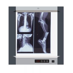 IN-1113 Professional Medical Led Film Viewer X-Ray View Box Dental X-Ray Film Illuminator Light Box X-ray Viewer LED Light