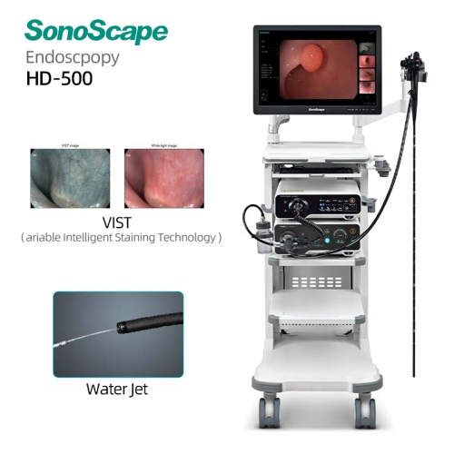 Sonoscape HD-500 High Definition Digital Endoscopy Platform with CMOS Image Enhancement Technology