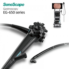 High Resolution SonoScape EG-650 Gastroscope for Advanced Hospital Diagnosis