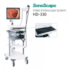 SonoScape HD-330 Cost-effective Medical Equipment for Diagnostic Gastroscopy