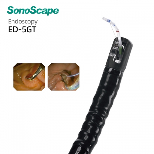 Removable Distal Cap Duodenoscope SonoScape ED-5GT for Advanced Infection Control