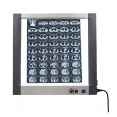 IN-1113 Mplent Double Sheets Led X-ray Film Viewer Adjustable LED Illuminated Film Viewer Factory Direct Price