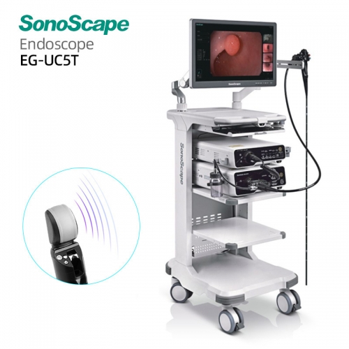 Top Quality Sonoscape EG-UC5T Endoscopic Ultrasound EUS System with High Resolution Convex Array Imaging