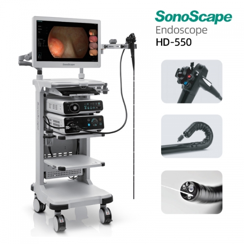 Sonoscape HD-550 Endoscopy System with SFI VIST Staining Chromoendoscopy and Multi Spectrum Imaging