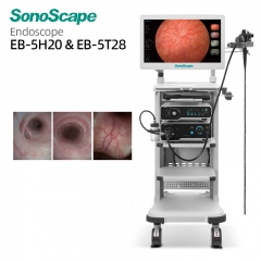 SonoScape EB-5H20 & EB-5T28 High-Resolution Interventional Bronchoscope for Pulmonologists