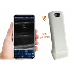 CProbe-6X Medical Equipment Handheld Mobile Wireless Scanner Accurate Puncture Linear Probe Type Ultrasound Scanner