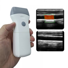 CProbe-9L Replaceable Battery Linear Probe 3D 4D Color Doppler Ultrasonido Machine Wireless Wifi Portable Ultrasound Scanner