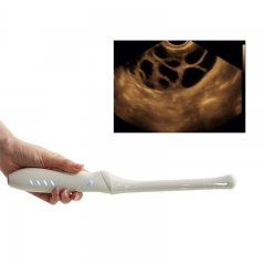 CProbe-4T Handheld Transvaginal Array Endocavity Ultrasonic Probe Wireless Color Doppler Palm Ultrasound Monitoring Device