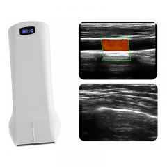 CProbe-6L6P Wireless 3in1 Palm Doppler Linear Ultrasound Scanner 3.5/5 MHz 7.5/10MHz 128 element Probe