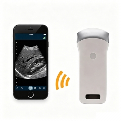 UProbe-3C Palm B/W Ultrasound Convex/linear Dual-head Wireless Probe Type B/W Ultrasound Scanner