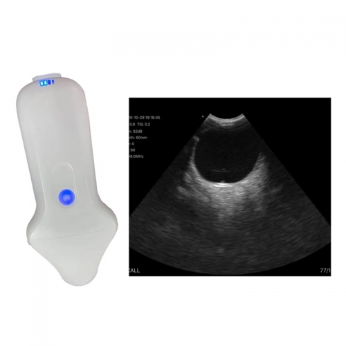 CProbe-4M Palm Doppler Ultrasound Micro-convex/linear Dual-head Wireless Probe Type Color Doppler Ultrasound Scanner