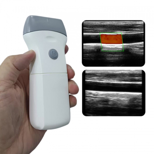 CProbe-9L Wireless Linear Doppler Ultrasound Scanner for Aesthetic and Vascular Imaging Portable Handheld Device Probe Linear