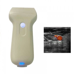 CProbe-3L Wireless Color Doppler Ultrasound Scanner 192 Elements Palm Portable Linear Array