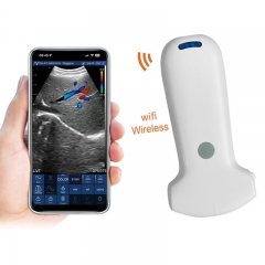 CProbe-8C Wireless Color Doppler Ultrasound Scanner With 96 Elements Convex Palm Doppler Ultrasound Scanner