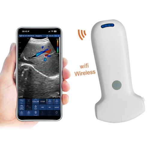 CProbe-8C Wireless Color Doppler Ultrasound Scanner With 96 Elements Convex Palm Doppler Ultrasound Scanner