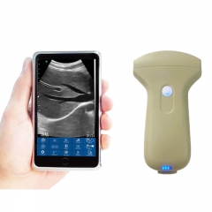 CProbe-3C Handheld Portable Medical Color Doppler MSK Venous Ultrasound Scanner 3C Convex Palm Doppler Ultrasound