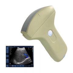 CProbe-3C Handheld Portable Medical Color Doppler MSK Venous Ultrasound Scanner 3C Convex Palm Doppler Ultrasound